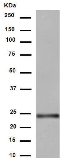 Western blot - Anti-RAB8A antibody [EPR14873] (AB188574)