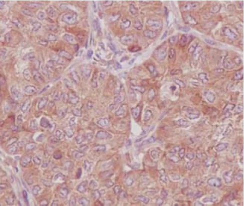 Immunohistochemistry (Formalin/PFA-fixed paraffin-embedded sections) - Anti-RAB8A antibody [EPR14873] - BSA and Azide free (AB271954)