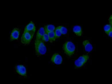 Immunocytochemistry/ Immunofluorescence - Anti-RAB8A antibody [EPR14873] - Low endotoxin, Azide free (AB221780)