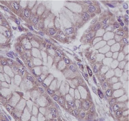 Immunohistochemistry (Formalin/PFA-fixed paraffin-embedded sections) - Anti-RAB8A antibody [EPR14873] - Low endotoxin, Azide free (ab221780), expandable thumbnail