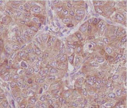 Immunohistochemistry (Formalin/PFA-fixed paraffin-embedded sections) - Anti-RAB8A antibody [EPR14873] - Low endotoxin, Azide free (AB221780), expandable thumbnail