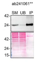 Immunoprecipitation - Anti-RAB8A antibody [MJF-R22-79-3] (AB241061)