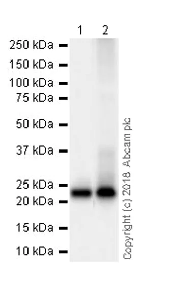 Western blot - Anti-RAB8A antibody [MJF-R22-79-3] (AB241061)