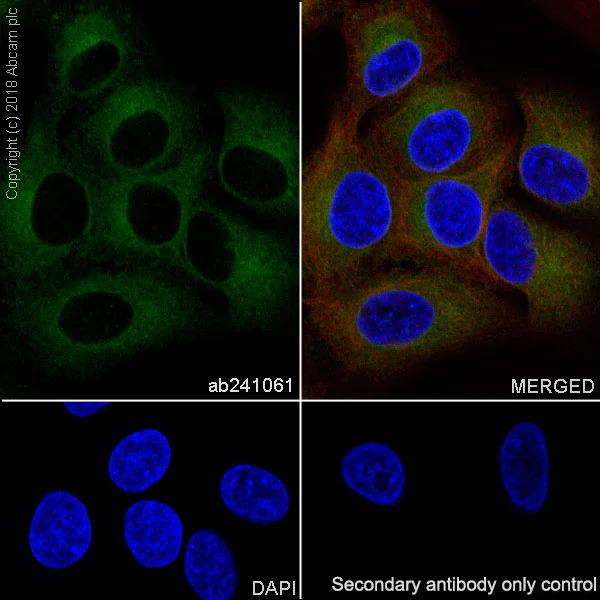 Immunocytochemistry/ Immunofluorescence - Anti-RAB8A antibody [MJF-R22-79-3] - BSA and Azide free (AB243568)