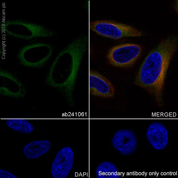 Immunocytochemistry/ Immunofluorescence - Anti-RAB8A antibody [MJF-R22-79-3] - BSA and Azide free (AB243568)