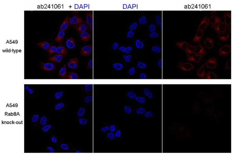 Immunocytochemistry/ Immunofluorescence - Anti-RAB8A antibody [MJF-R22-79-3] - BSA and Azide free (AB243568)