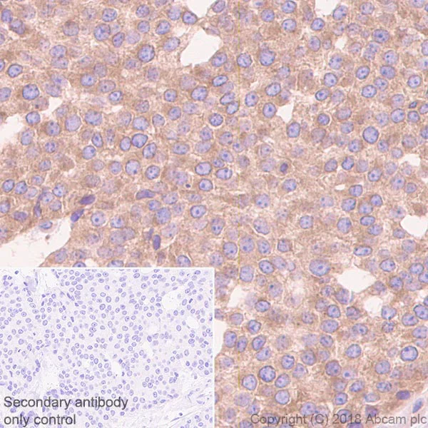 Immunohistochemistry (Formalin/PFA-fixed paraffin-embedded sections) - Anti-RAB8A antibody [MJF-R22-79-3] - BSA and Azide free (AB243568)