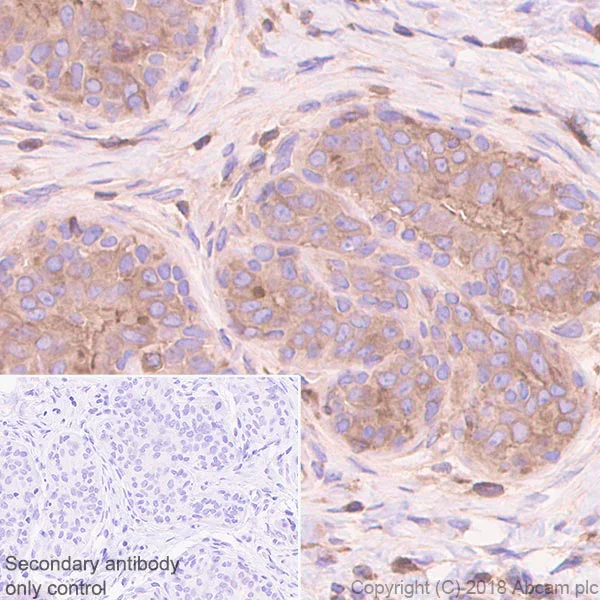 Immunohistochemistry (Formalin/PFA-fixed paraffin-embedded sections) - Anti-RAB8A antibody [MJF-R22-79-3] - BSA and Azide free (AB243568)