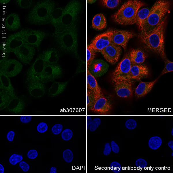 Immunocytochemistry/ Immunofluorescence - Anti-RAB8A antibody [MJF-R22-79-3] - Mouse IgG2a (Chimeric) (AB307607)