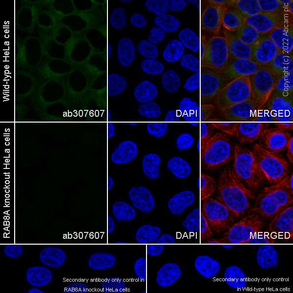 Immunocytochemistry/ Immunofluorescence - Anti-RAB8A antibody [MJF-R22-79-3] - Mouse IgG2a (Chimeric) (AB307607), expandable thumbnail