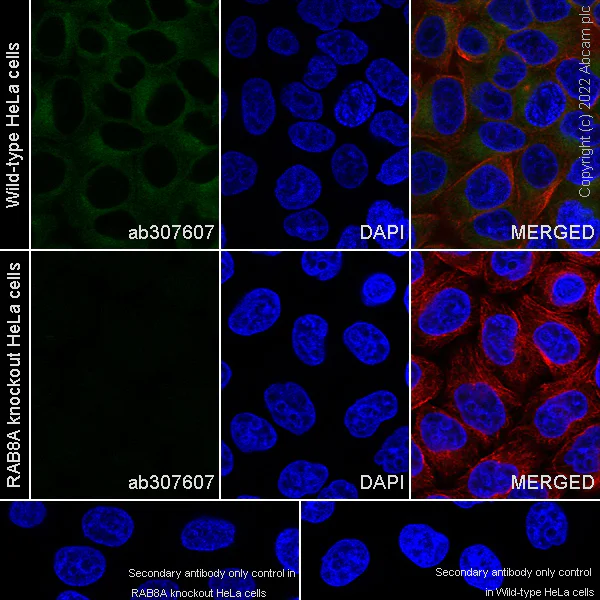 Immunocytochemistry/ Immunofluorescence - Anti-RAB8A antibody [MJF-R22-79-3] - Mouse IgG2a (Chimeric) (AB307607)