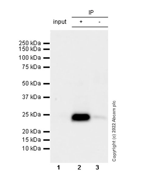 Immunoprecipitation - Anti-RAB8A antibody [MJF-R22-79-3] - Mouse IgG2a (Chimeric) (AB307607), expandable thumbnail