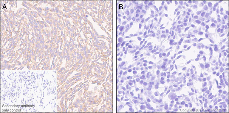 Immunohistochemistry - Anti-RAB8A antibody [MJF-R22-79-3] - Mouse IgG2a (Chimeric) - BSA and Azide free (AB307608)