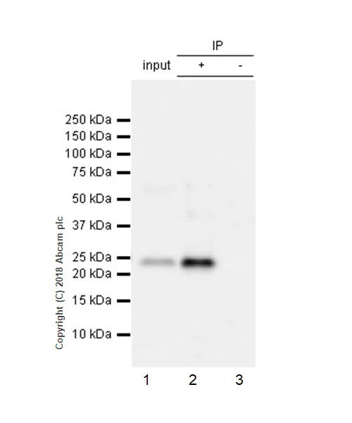 Immunoprecipitation - Anti-RAB8A antibody [MJF-R22] (AB237702)