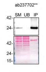 Immunoprecipitation - Anti-RAB8A antibody [MJF-R22] (AB237702)