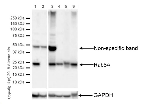 Western blot - Anti-RAB8A antibody [MJF-R22] (AB237702)