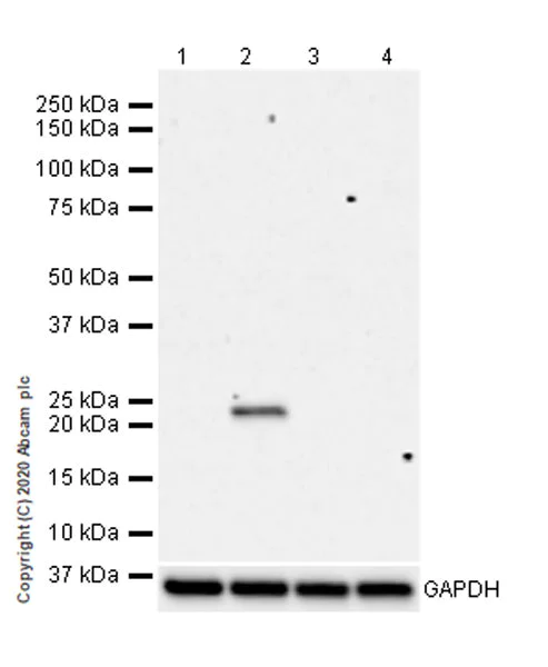Western blot - Anti-RAB8A (phospho S111) antibody [MJF-R27-30] (AB267492)