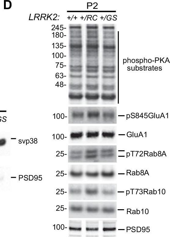 Western blot - Anti-RAB8A (phospho T72) antibody [MJF-R20] (AB230260), expandable thumbnail