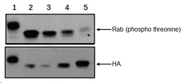 Western blot - Anti-RAB8A (phospho T72) antibody [MJF-R20] - BSA and Azide free (AB231706)