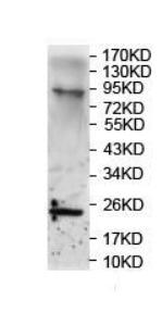 Western blot - Anti-RAB8B antibody (AB124356)