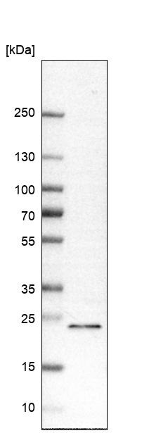 Western blot - Anti-RAB8B antibody (AB222017)