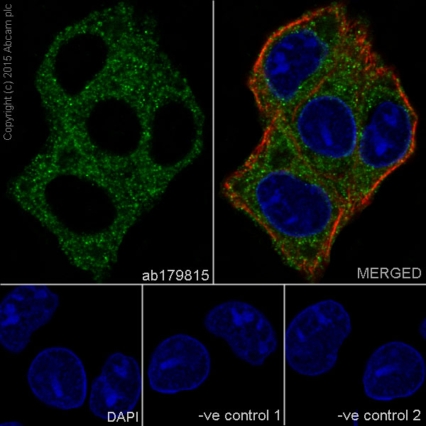 Immunocytochemistry/ Immunofluorescence - Anti-Rab9 antibody [EPR13272] - BSA and Azide free (AB236127)