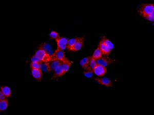 Immunocytochemistry/ Immunofluorescence - Anti-Rab9 antibody [EPR13272] - Late Endosome Marker (AB179815)