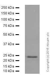 Western blot - Anti-Rab9 antibody [EPR13272] - Late Endosome Marker (AB179815)