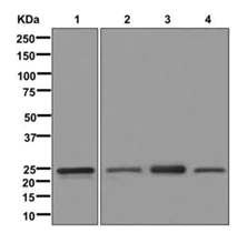 Western blot - Anti-Rab9 antibody [EPR13272] - Late Endosome Marker (AB179815)