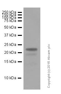 Western blot - Anti-Rab9 antibody [EPR13272] - Late Endosome Marker (AB179815)