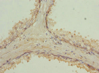 Immunohistochemistry (Formalin/PFA-fixed paraffin-embedded sections) - Anti-Rab9 antibody - Late Endosome Marker (AB235538), expandable thumbnail