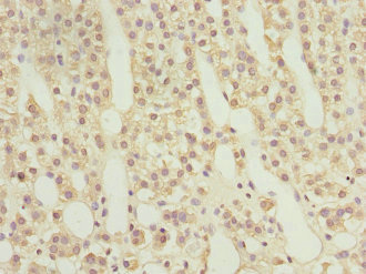 Immunohistochemistry (Formalin/PFA-fixed paraffin-embedded sections) - Anti-Rab9 antibody (AB235538), expandable thumbnail