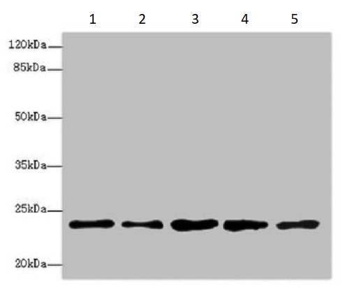 Western blot - Anti-Rab9 antibody - Late Endosome Marker (AB235538), expandable thumbnail