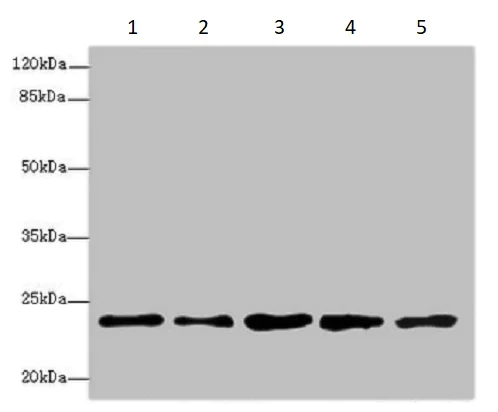Western blot - Anti-Rab9 antibody - Late Endosome Marker (AB235538)