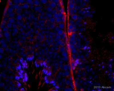 Immunohistochemistry (Formalin/PFA-fixed paraffin-embedded sections) - Anti-Rab9 antibody [Mab9] - Late Endosome Marker (AB2810)
