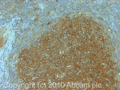 Immunohistochemistry (Formalin/PFA-fixed paraffin-embedded sections) - Anti-Rab9 antibody [Mab9] - Late Endosome Marker (AB2810)