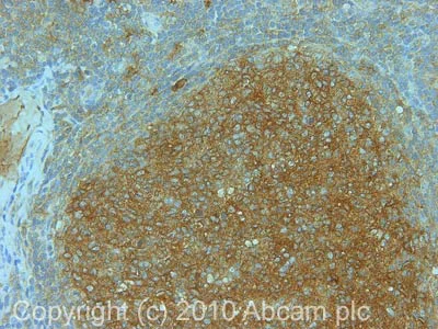 Immunohistochemistry (Formalin/PFA-fixed paraffin-embedded sections) - Anti-Rab9 antibody [Mab9] - Late Endosome Marker (AB2810)
