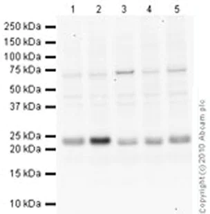 Western blot - Anti-Rab9 antibody [Mab9] - Late Endosome Marker (AB2810)