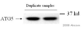 Western blot - Rabbit Anti-Chicken IgY H&L (HRP) (AB6753), expandable thumbnail