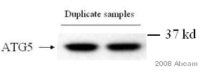 Western blot - Rabbit Anti-Chicken IgY H&L (HRP) (AB6753)