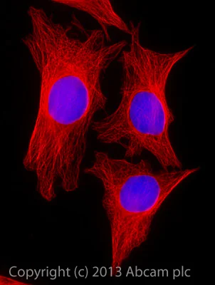 Immunocytochemistry/ Immunofluorescence - Rabbit F(ab')2 Anti-Rat IgG H&L (Alexa Fluor® 647) (AB169349)