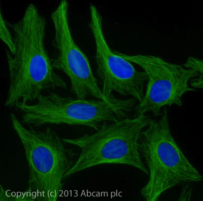 amiページ Donkey anti-rabbit IgG Alexa Fluor® 647 secondary antibody