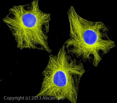 Immunocytochemistry/ Immunofluorescence - Rabbit Anti-Goat IgG H&L (Alexa Fluor® 555) preadsorbed (AB150146), expandable thumbnail