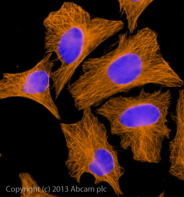 Immunocytochemistry/ Immunofluorescence - Rabbit Anti-Goat IgG H&L (Alexa Fluor® 594) preadsorbed (AB150148), expandable thumbnail