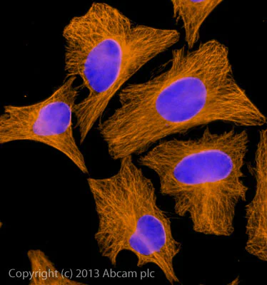 Immunocytochemistry/ Immunofluorescence - Rabbit Anti-Goat IgG H&L (Alexa Fluor® 594) preadsorbed (AB150148)