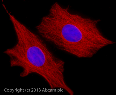 Immunocytochemistry/ Immunofluorescence - Rabbit Anti-Goat IgG H&L (Alexa Fluor® 647) preadsorbed (AB150147), expandable thumbnail