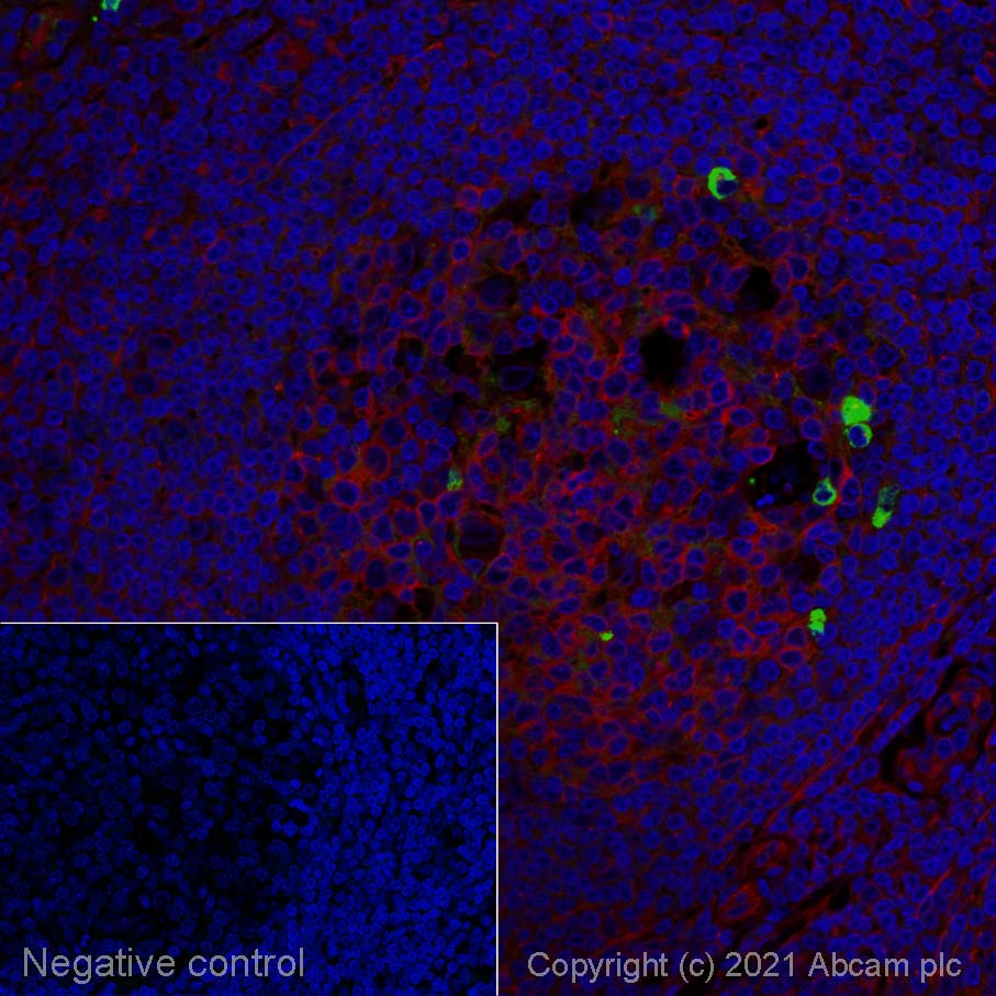 Immunohistochemistry (Formalin/PFA-fixed paraffin-embedded sections) - Rabbit Anti-Human IgM mu chain (Alexa Fluor® 488) (AB150189), expandable thumbnail