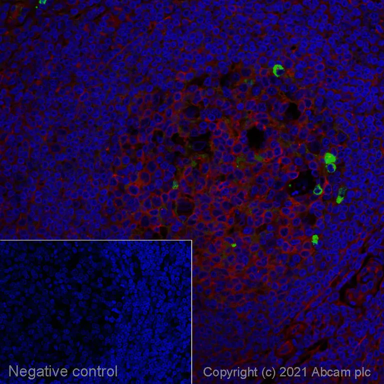 Immunohistochemistry (Formalin/PFA-fixed paraffin-embedded sections) - Rabbit Anti-Human IgM mu chain (Alexa Fluor® 488) (AB150189)