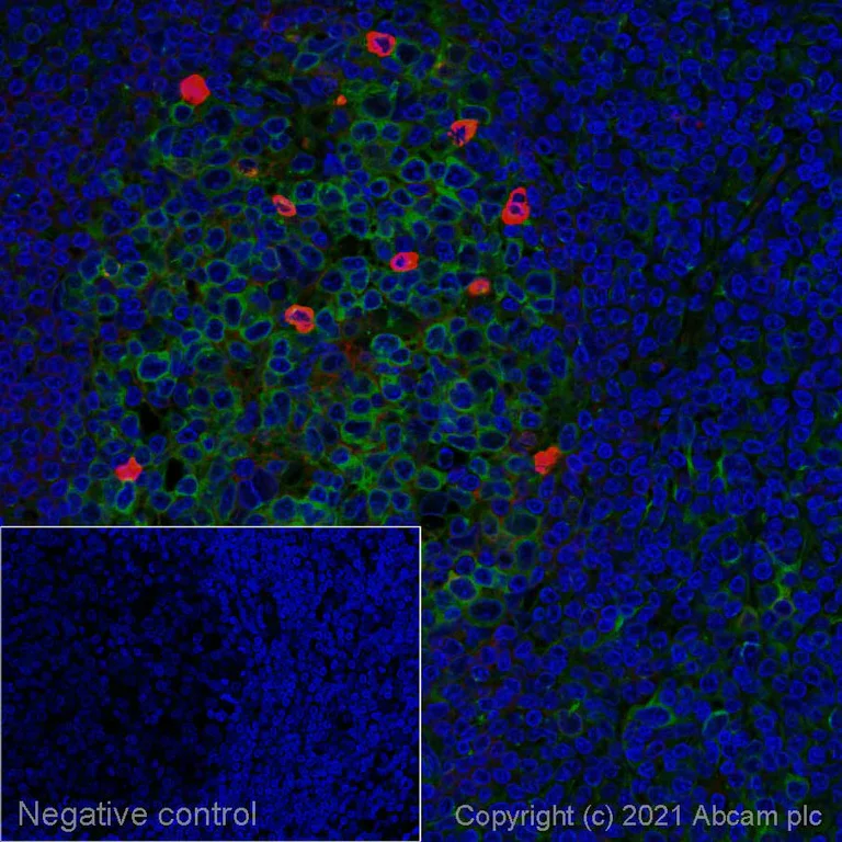 Immunohistochemistry (Formalin/PFA-fixed paraffin-embedded sections) - Rabbit Anti-Human IgM mu chain (Alexa Fluor® 647) (AB150191)