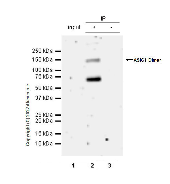 Immunoprecipitation - Rabbit IgG, monoclonal [EPR25A] - Isotype Control (ab172730), expandable thumbnail